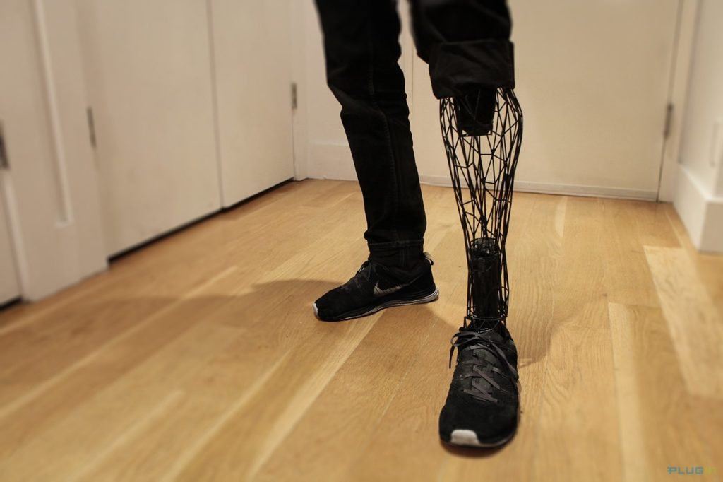 sensible-prosthetics